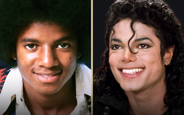 Michael Jackson's Plastic Surgery Journey