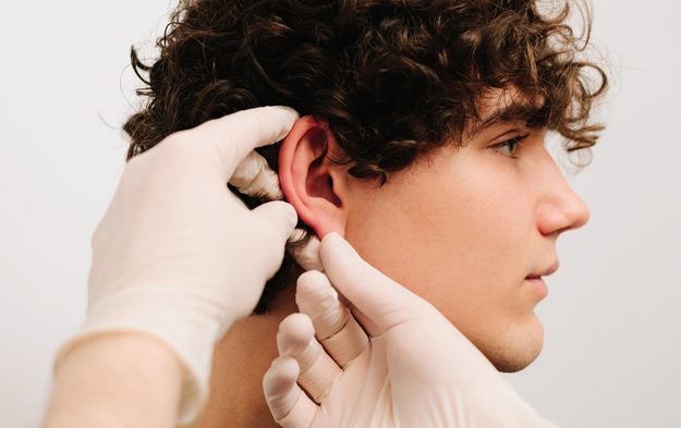Otoplasty in Turkey: The Real Cost of Ear Surgery Revealed